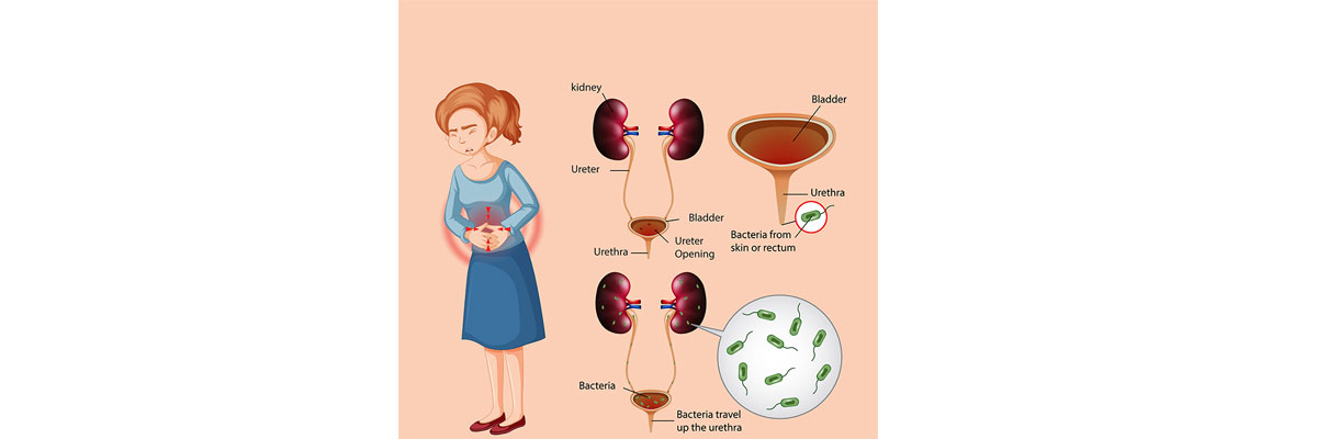 Female Urology